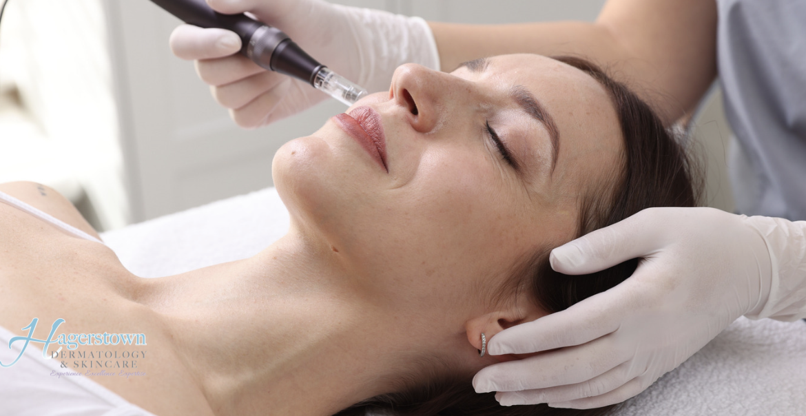 Cosmetic Dermatology Consultation Near McLean, Virginia